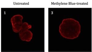 Метиленово синьп лекува прогерия , Oxidal , оксидал